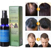 Organic Andrea hair growth essence bottle with natural ingredients, ideal for promoting hair growth and scalp nourishment.

